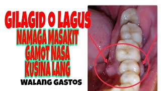 Gilagid o Lagus namaga gamot Na walang gastos na sa kusina lang [upl. by Claudy444]