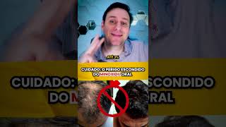 CUIDADO os perigos do MINOXIDIL ORAL [upl. by Chally]