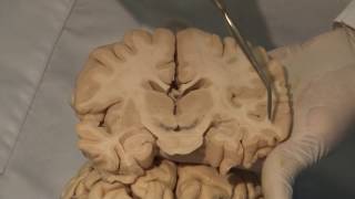 Cortical Localization Neuroanatomy Video Lab  Brain Dissections [upl. by Rezal]