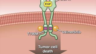 Osimertinib in Advanced Non–SmallCell Lung Cancer [upl. by Ahsinrac]