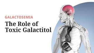 Galactosemia Pathogenesis The Role of Toxic Galactitol [upl. by Mori]