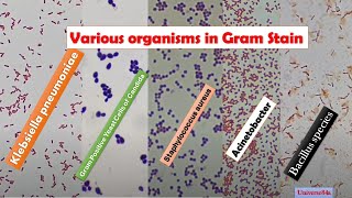 Various Bacteria Gram Stain MicroscopyGrampositive rodsGramNegative RodsGrampositive cocci [upl. by Anchie376]