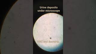 RBC and bacteria under microscope  Urine examination  medicallabtechnologysajal6903 [upl. by Llenoj]