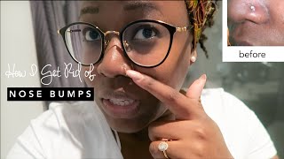 HOW TO GET RID OF A NOSE PIERCING BUMP KELOID FAST  hellotinashe [upl. by Gennie197]