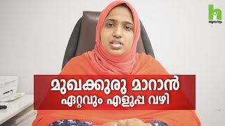 മുഖക്കുരു എളുപ്പം സുഖപ്പെടുത്താം  Pimple treatment malayalam health tips [upl. by Ahser]