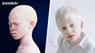 8 Datos sorprendentes de Los Albinos que no sabías [upl. by Noffihc]