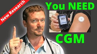 You NEED a CGM Who needs a Continuous Glucose Monitor [upl. by Seppala724]