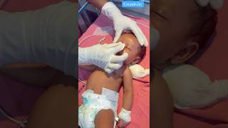 Newborn Nose Massage nicu newbornbaby medical [upl. by Eelatan505]