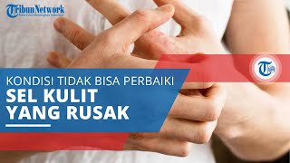 Eksim Penyakit Kulit yang Muncul akibat Kulit Tidak Bisa Memperbaiki Sel yang Rusak [upl. by Wiersma483]