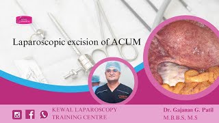 Laparoscopic excision of ACUM Kewal Hospital  Laparoscopy Training [upl. by Aharon]