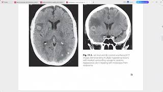 EMERGENCY CROSS SECTIONAL RADIOLOGY [upl. by Yblocaj84]