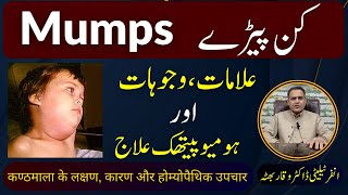 Mumps کن پیڑے कण्ठमाला का रोग Homeopathic Treatment Symptoms by DrWaqar Bhutta  Urdu  Hindi [upl. by Einama]