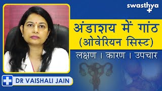 अंडाशय में गांठ ओवेरियन सिस्ट  कारण लक्षण उपाय  Dr Vaishali Jain on Ovarian Cyst in Hindi [upl. by Coralyn]