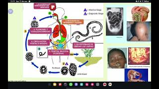 NEMATODOS Enterovius trichuris Ascaris Strongyloides Uncinarias Filariasis Oncocercosisetc💀🧫 [upl. by Lasky]