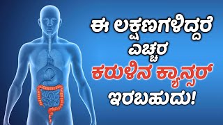 Colorectal Cancer Symptoms amp Treatment  Vijay Karnataka [upl. by Nnywg]