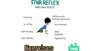 Simple exercises for STNR reflexes [upl. by Tallou]