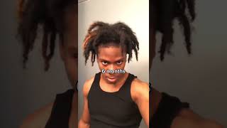 3 Year Dreadlock Journey viral dreadlocks dreads locs hair shorrts [upl. by Ppik]