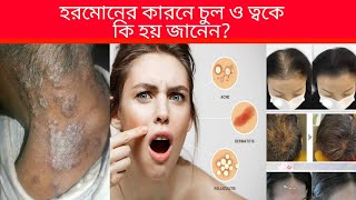 হরমোন কিকেন হরমোনাল সমস্যা হয়। what is hormonal  how to remove hormonal skin amp hair problem [upl. by Ardra884]