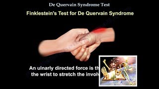 De Quervain Syndrome Test  Everything You Need To Know  Dr Nabil Ebraheim [upl. by Byrom459]