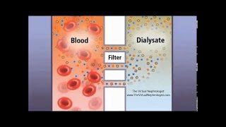 Hemodialysis Hemofilter and countercurrent animation [upl. by Attenborough592]