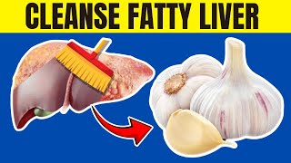 10 Powerful Foods to Cleanse Your Fatty Liver Fast [upl. by Erminie]