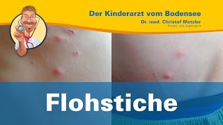 Flohstiche juckende Punkte in einer Reihe  Der Kinderarzt vom Bodensee [upl. by Greenleaf156]