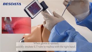 How to get the best view for airway intubation with video laryngoscope [upl. by Maude]