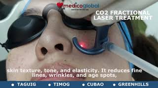 co2 fractional laser for acne scar melasma skin rejuvenation [upl. by Andreas347]