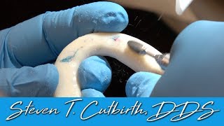 TMJ Treatment Part 3 of 4  Dental Minute with Steven T Cutbirth DDS [upl. by Humbert]