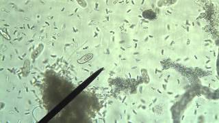 Protists Amoeba Euglena Paramecium [upl. by Necaj126]