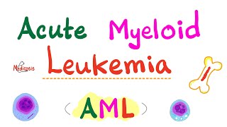 Acute Myeloid Leukemia AML  Auer Rods  Myeloperoxidase Positive  Hematology amp Oncology Series [upl. by Goldy]