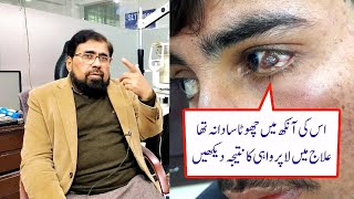 Conjunctival Lesion may examine and treated well in time  in Urdu Hindi [upl. by Jahn]