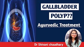 Gallbladder polyp  Ayurvedic treatment ayurveda ayurvedictreatment [upl. by Lull]