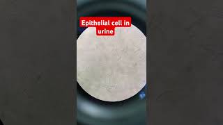 Epithelial cells in urine [upl. by Eitsyrhc]