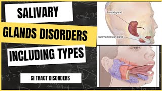 Salivary glands disorders  Understanding causes symptoms and treatment [upl. by Eremahs]