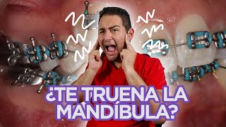 😖 ”ME TRUENA LA MANDÍBULA” 😖 ¡DEBERÍAS VER ESTE VIDEO😍 🔥CASO de CHASQUIDOS RESUELTO en 2021🔥 [upl. by Nehtanhoj]