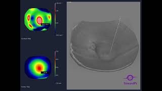 3D quotFundus Curvaturequot launched by TowardPi SSOCT [upl. by Llovera]