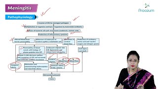 Meningitis Hindi  Internal Medicine [upl. by Aenyl]