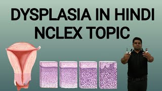 Dysplasia in hindi  Dysplasia Pathology in Hindi  Dysplasia Causes  Dysplasia kya hai [upl. by Davina841]