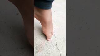 You Wont Believe This Skipping Rope With One Toe 😱😱 funny comedy shorts [upl. by Vocaay702]