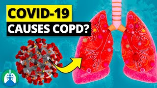 Can COVID19 Cause COPD [upl. by Landa]