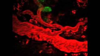 NIDCR Vascular Flow Close to a Lymph Node in a Live Mouse Harboring a Metastatic Tumor [upl. by Bjork]