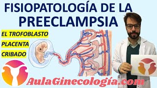 FISIOPATOLOGÍA DE LA PREECLAMPSIA DESARROLLO de la PLACENTA ANORMAL Ginecología y Obstetricia [upl. by Ahtelat897]