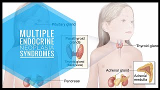 Multiple Endocrine Neoplasia  Rapid Review [upl. by Melliw]