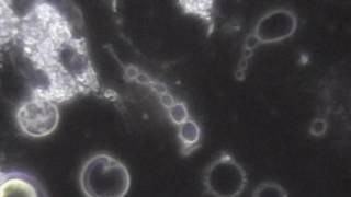 LIVE BLOOD CELL ANALYSIS WHITE BLOOD CELLS vs BACTERIA [upl. by Aillicsirp]