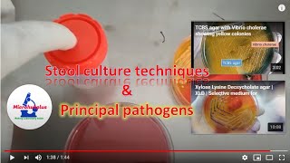 Stool culture techniques for isolation of enteric pathogens like Salmonella Shigella and Vibrio [upl. by Alleda985]