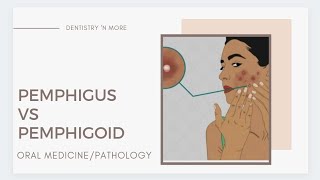 PEMPHIGUS VS PEMPHIGOID [upl. by Emlynn]