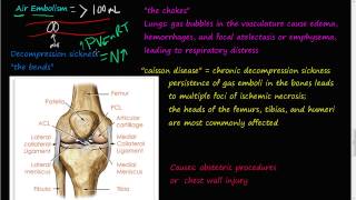 62P  Air Embolism decompression sickness the bends the chokes cassion disease [upl. by Akehsar]