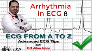 ECG from A to Z intermediate level Arrhythmia 8 Dr Alaa Nasr 2019 [upl. by Noscire]