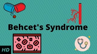 Behcets Syndrome Causes Signs and Symptoms Diagnosis and Treatment [upl. by Eellah]